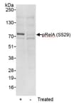 Detection of human Phospho RelA (S529) by western blot.