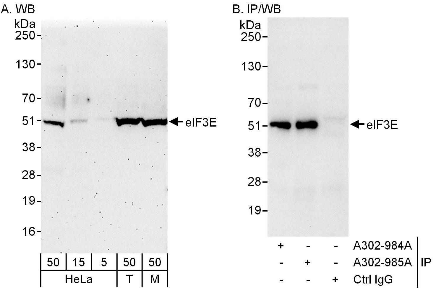 Detection of human and mouse eIF3E by western blot (h&amp;m) and immunoprecipitation (h).