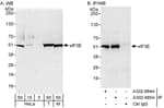 Detection of human and mouse eIF3E by western blot (h&amp;m) and immunoprecipitation (h).