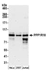 Detection of human PPP1R18 by western blot.