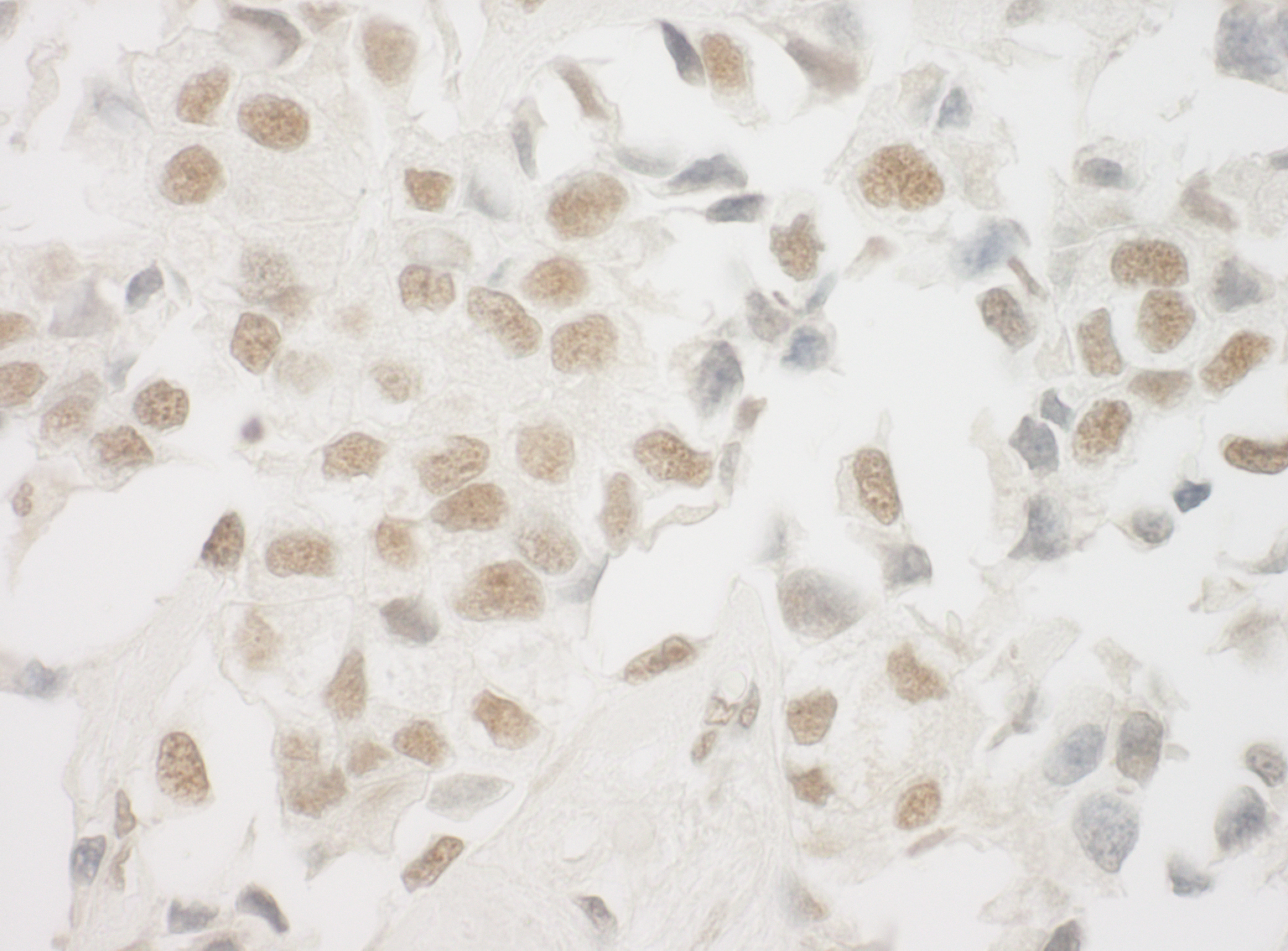 Rabbit anti-Ku70 IHC Antibody