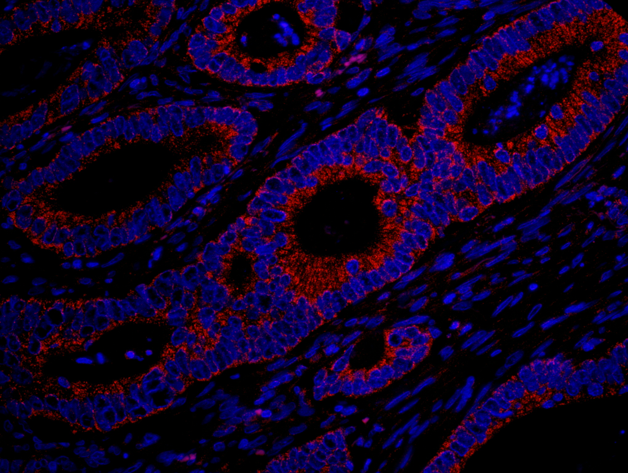 Rabbit anti-MADD IHC Antibody