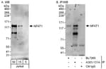 Detection of human NFAT1 by western blot and immunoprecipitation.