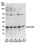 Detection of human and mouse E2-25K by western blot.