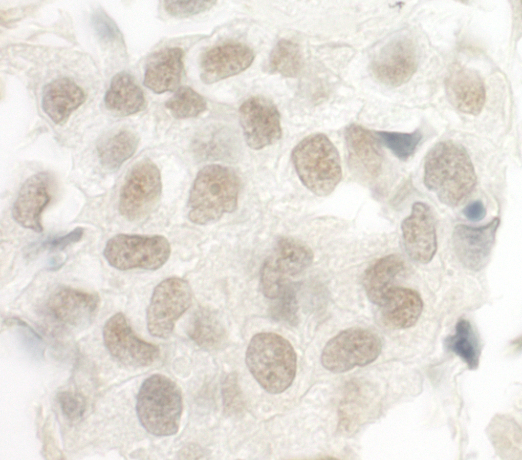 Rabbit anti-FOXP1 IHC Antibody