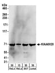 Detection of human KIAA0020 by western blot.