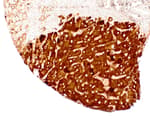 Detection of human HBsAg by immunohistochemistry.