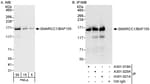Detection of human SMARCC1/BAF155 by western blot and immunoprecipitation.