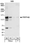 Detection of human PRPF4B by western blot.