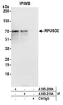 Detection of human RPUSD2 by western blot of immunoprecipitates.