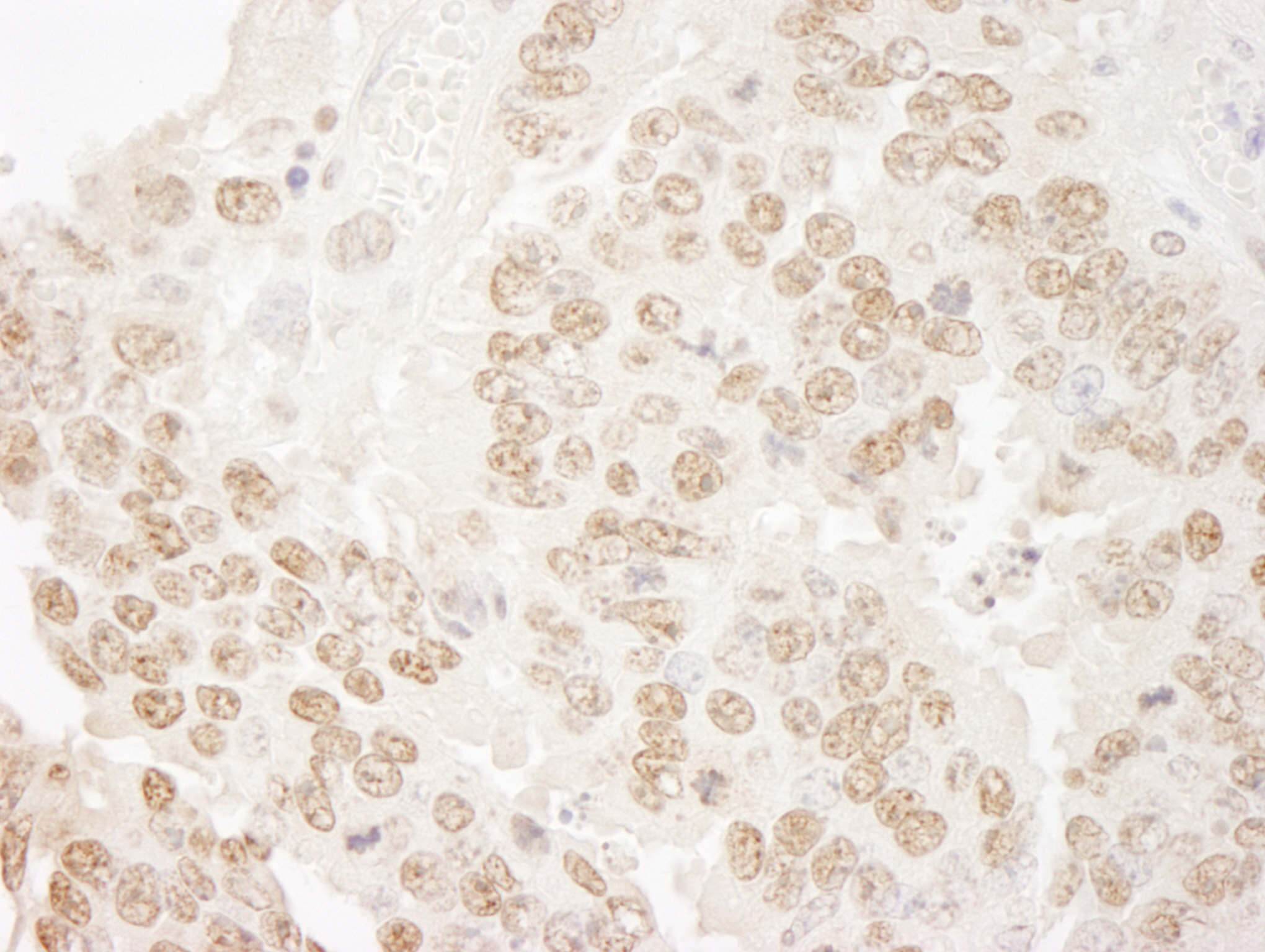 Detection of mouse hPrp3p immunohistochemistry.