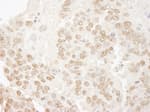 Detection of mouse hPrp3p immunohistochemistry.