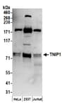 Detection of human TNIP1 by western blot.