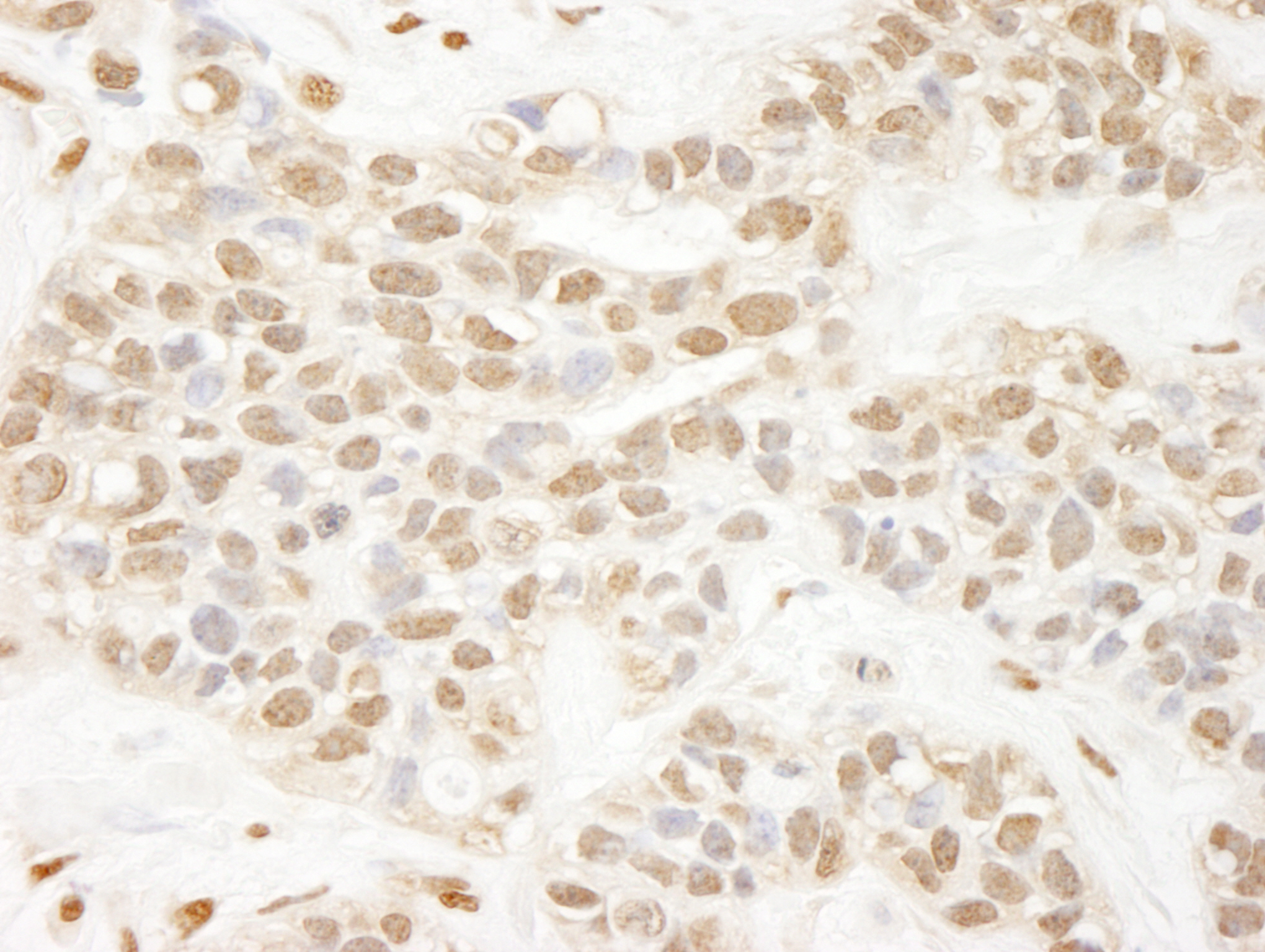 Rabbit anti-Pc2 IHC Antibody
