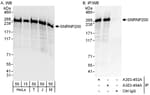 Detection of human and mouse SNRNP200 by western blot (h and m) and immunoprecipitation (h).