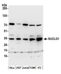 Detection of human and mouse SUCLG1 by western blot.
