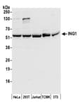 Detection of human and mouse ING1 by western blot.