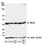 Detection of human MICU2 by western blot.