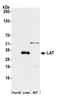 Detection of human LAT by western blot.