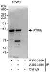 Detection of human ATMIN by western blot of immunoprecipitates.