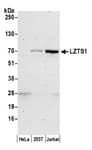 Detection of human LZTS1 by western blot.
