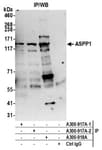 Detection of human ASPP1 by western blot of immunoprecipitates.