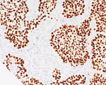 Detection of human p40 by immunohistochemistry.