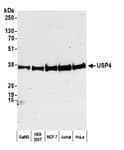Detection of human USP4 by western blot.