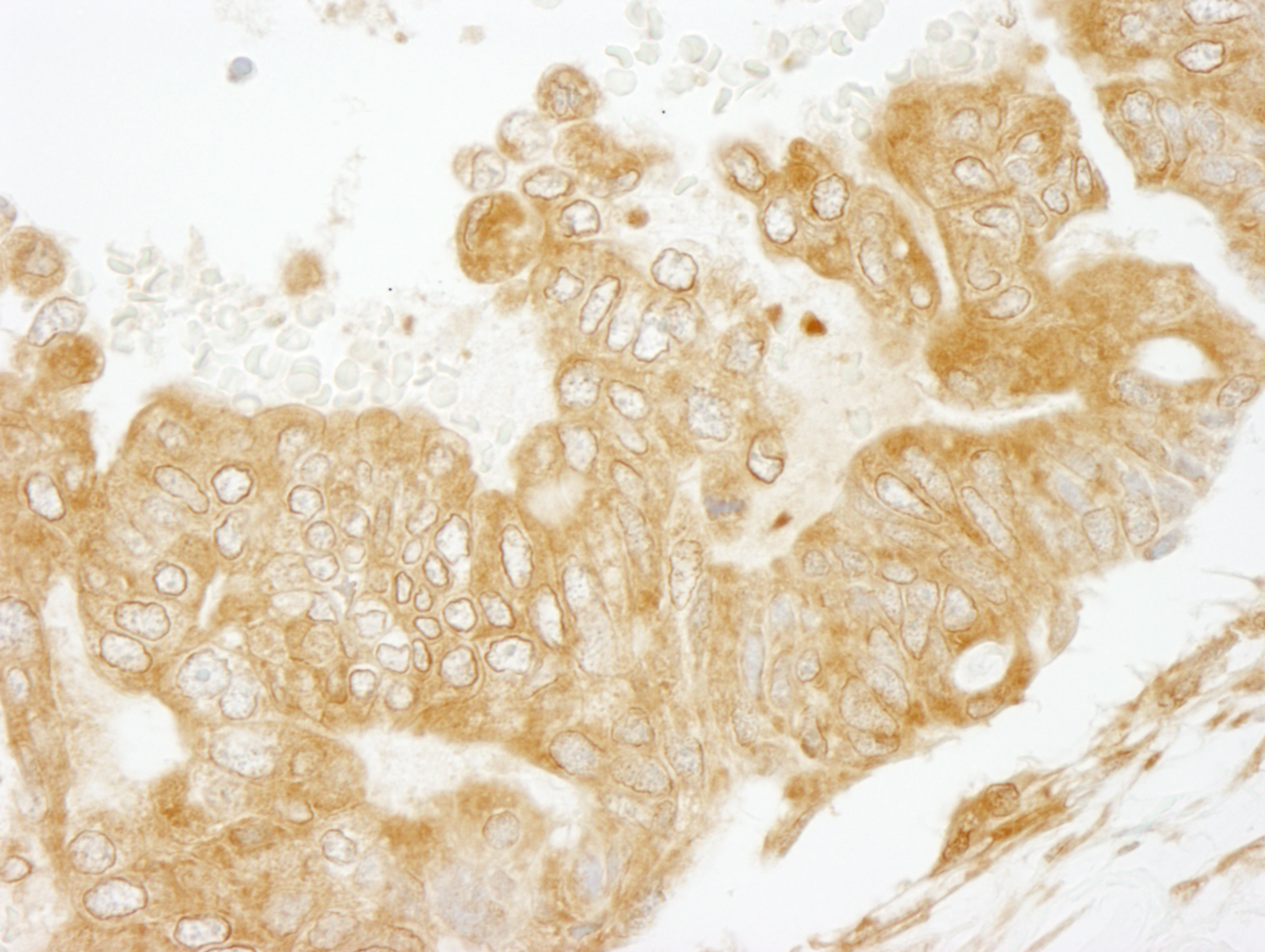 Rabbit anti-EEA1 IHC Antibody