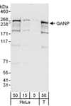 Detection of human GANP by western blot.