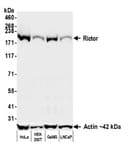 Detection of human Rictor by western blot.