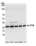 Detection of human and mouse ETFB by western blot.
