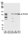 Detection of human and mouse TIP120B by western blot.