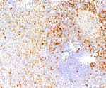 Detection of human ANXA1/Annexin A1 by immunohistochemistry.