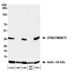 Detection of human STING/TMEM173 by western blot.