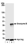 Detection of human Granzyme B by western blot.