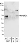 Detection of human MEF2A by western blot.
