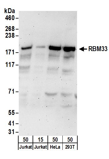 Detection of human RBM33 by western blot.