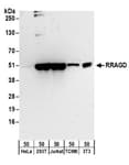 Detection of human and mouse RRAGD by western blot.