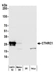 Detection of human CTHRC1 by western blot.