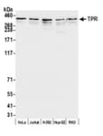 Detection of human TPR by western blot.