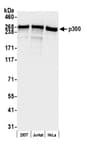 Detection of human p300 by western blot.