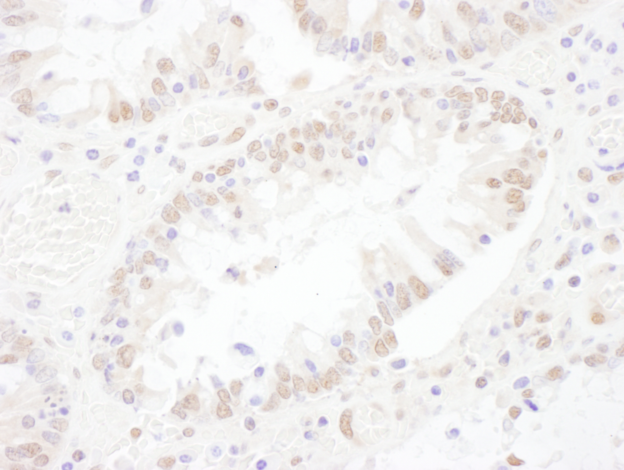 Detection of human SNRNP200 by immunohistochemistry.