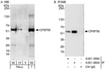Detection of human CPSF59 by western blot and immunoprecipitation.