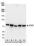 Detection of human and mouse GYS1 by western blot.