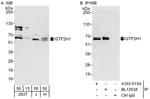 Detection of human GTF2H1 by western blot and immunoprecipitation.