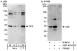 Detection of human CEE by western blot and immunoprecipitation.