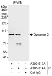 Detection of human Dynamin 2 by western blot of immunoprecipitates.
