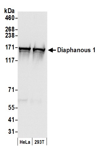 Detection of human Diaphanous by immunohistochemistry.
