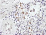 Detection of human MSH6 by immunohistochemistry.